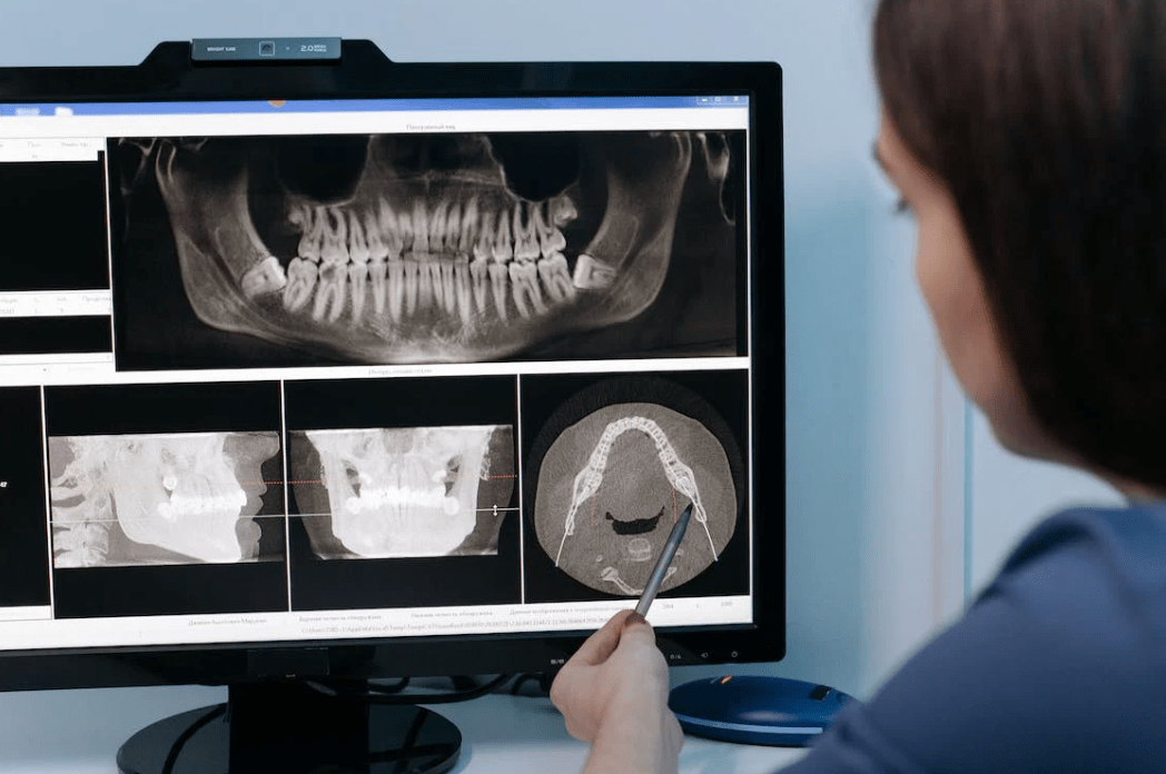 Nowoczesna diagnostyka stomatologiczna w 2023 – Prześwietlenie zębów RTG